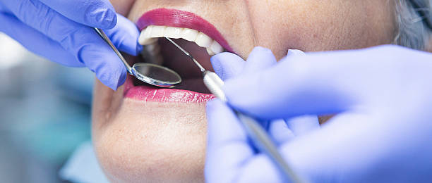 Best Emergency Dental Care for Sports Injuries in Boalsburg, PA